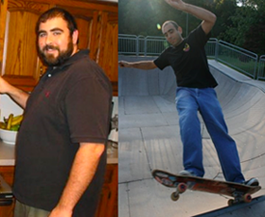 anthony_before_after-mid_0